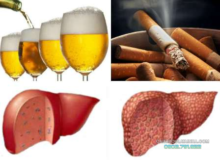 Hút thuốc lá là nguyên nhân dẫn tới viêm gan B