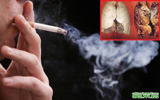 lợi ích cai thuốc lá